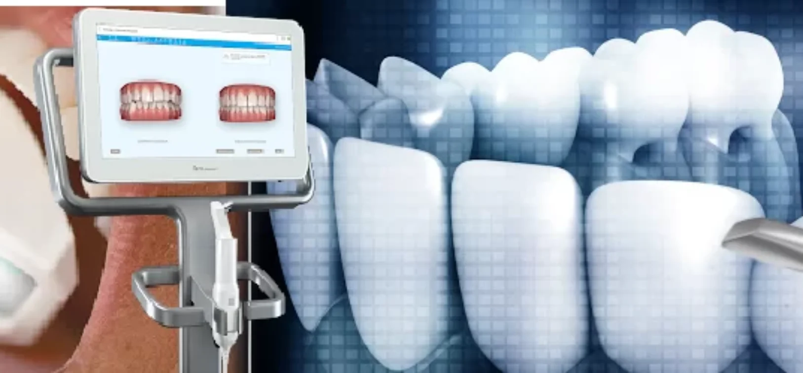 Billboard-Ad Blog inner thumb : Knighton Dental