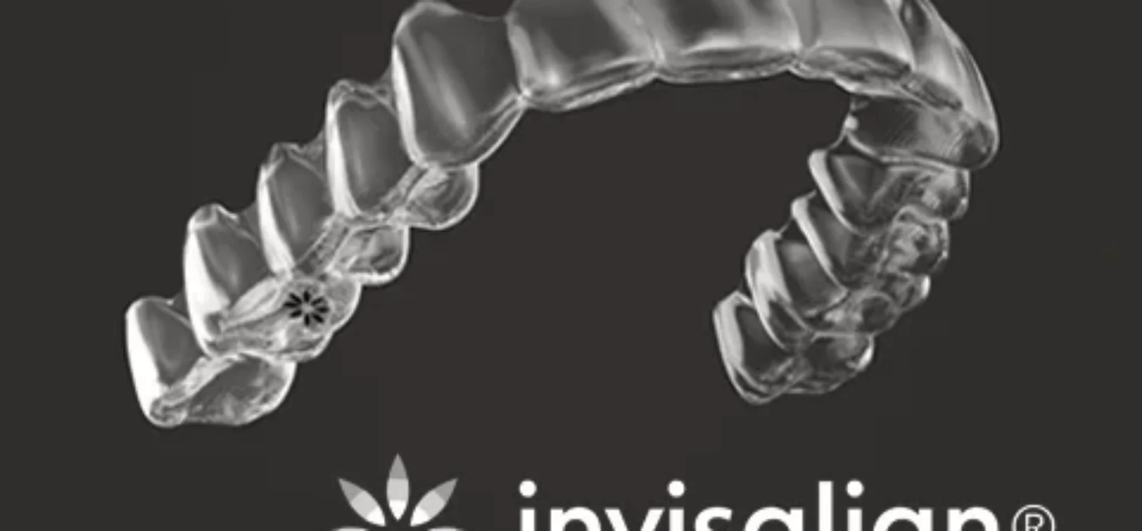Invisalign-Leicester Blog inner thumb : Knighton Dental